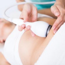 CoolSculpting : Est-ce réellement efficace et sans dangers ?